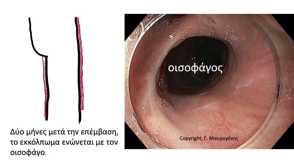 %CE%94%CE%B9%CE%B1%CF%86%CE%AC%CE%BD%CE%B5%CE%B9%CE%B15 | Iatromedia.gr